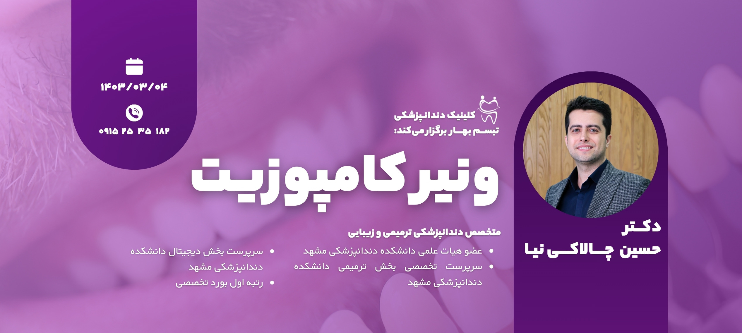 برگذاری دوره ونیر کامپزیت در کلینیک دندانپزشکی تبسم بهار سبزوار