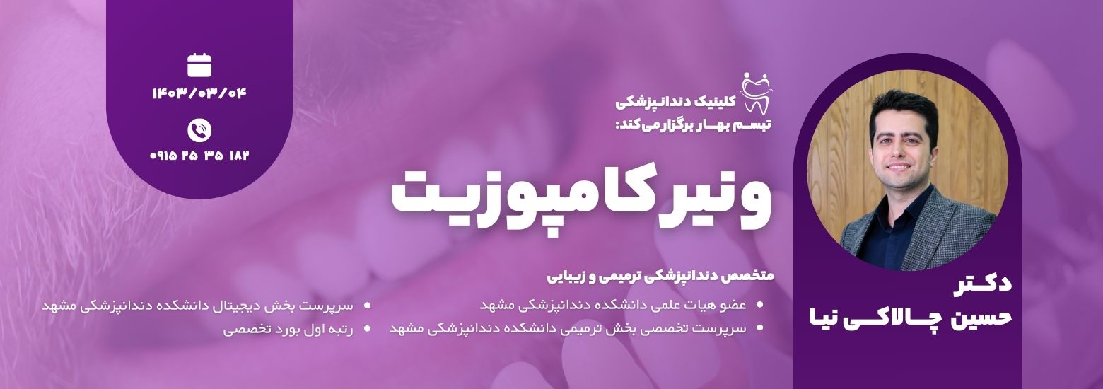 دوره ونیر کامپوزیت کلینیک دندانپزشکی تبسم بهار سبزوار